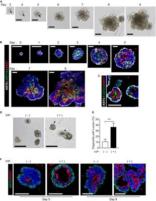 3D Organoid Culture From Adult Salivary Gland Tissues as an ex vivo Modeling of Salivary Gland Morphogenesis